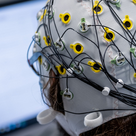 Des électrodes sur la tête d'un-e participant-e à une étude d'OpenUni Suisse
